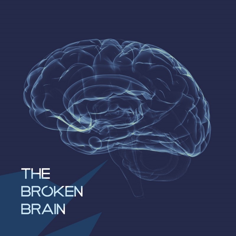 Bonus Podcast – Tim Pickett on Broken Brain Podcast